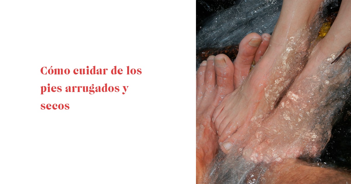 Cómo cuidar de los pies arrugados y secos